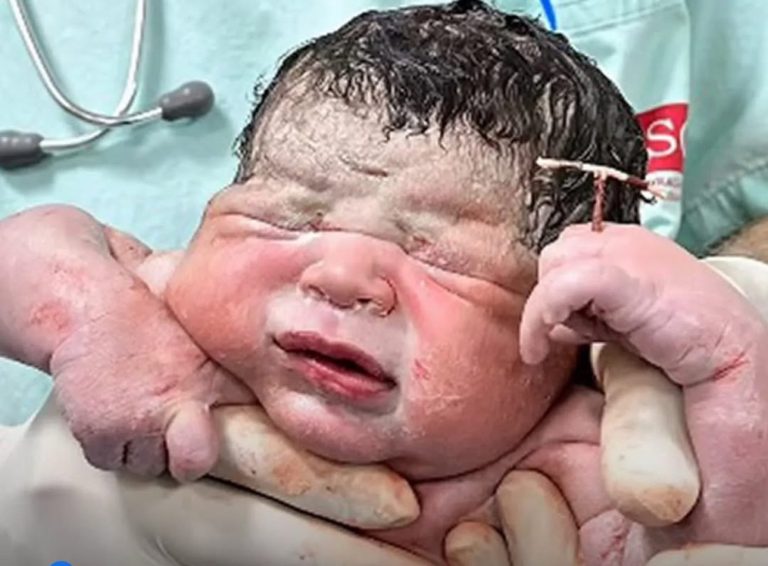 Baby Born Holding IUD After Contraceptive Failure Shocks Family