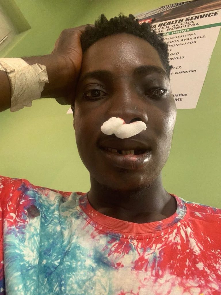 Family Appeals for GHC80,000 Surgery Support as He Fights for His Life 2 img 2095